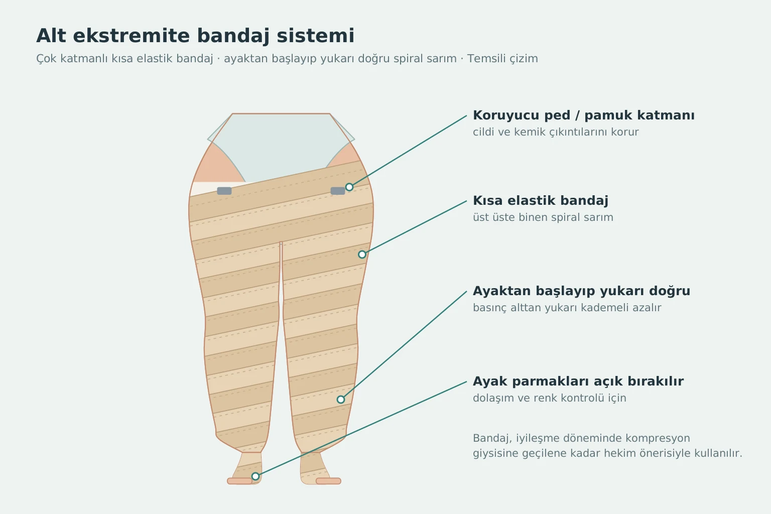 Endolazer sonrası alt ekstremite çok katmanlı bandaj sistemi