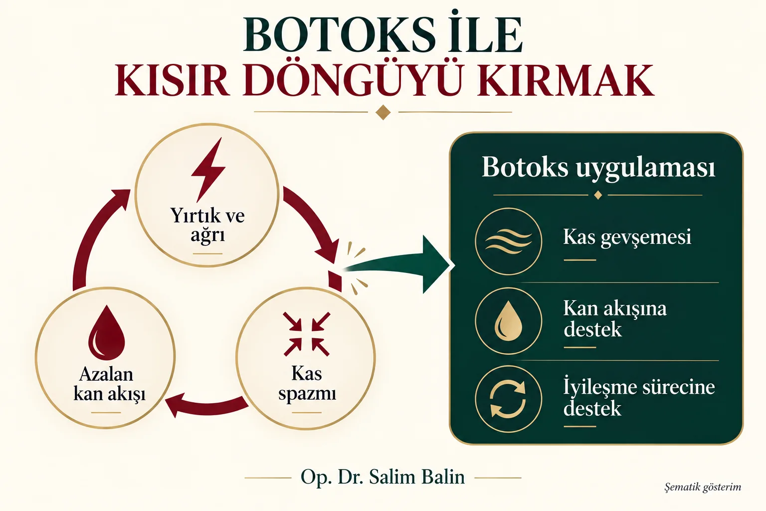 Botoks ile kısır döngüyü kırmak: yırtık ve ağrı, kas spazmı, azalan kan akışı; botoksla kas gevşemesi ve iyileşmeye destek – şematik gösterim